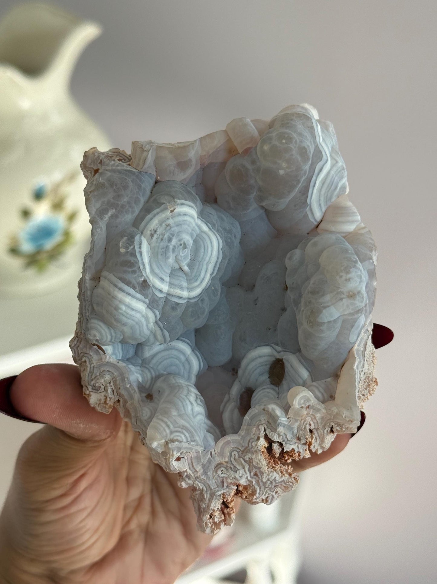 Rare Orca Agate Specimen – Raw Botryoidal Chalcedony Crystal, Natural Mineral Fossil, Collector’s Healing Stone Gift