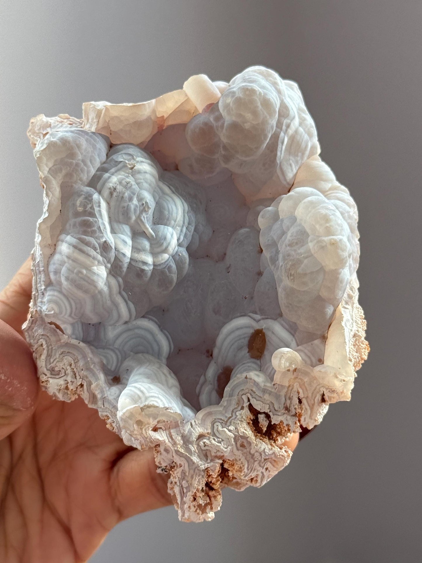 Rare Orca Agate Specimen – Raw Botryoidal Chalcedony Crystal, Natural Mineral Fossil, Collector’s Healing Stone Gift