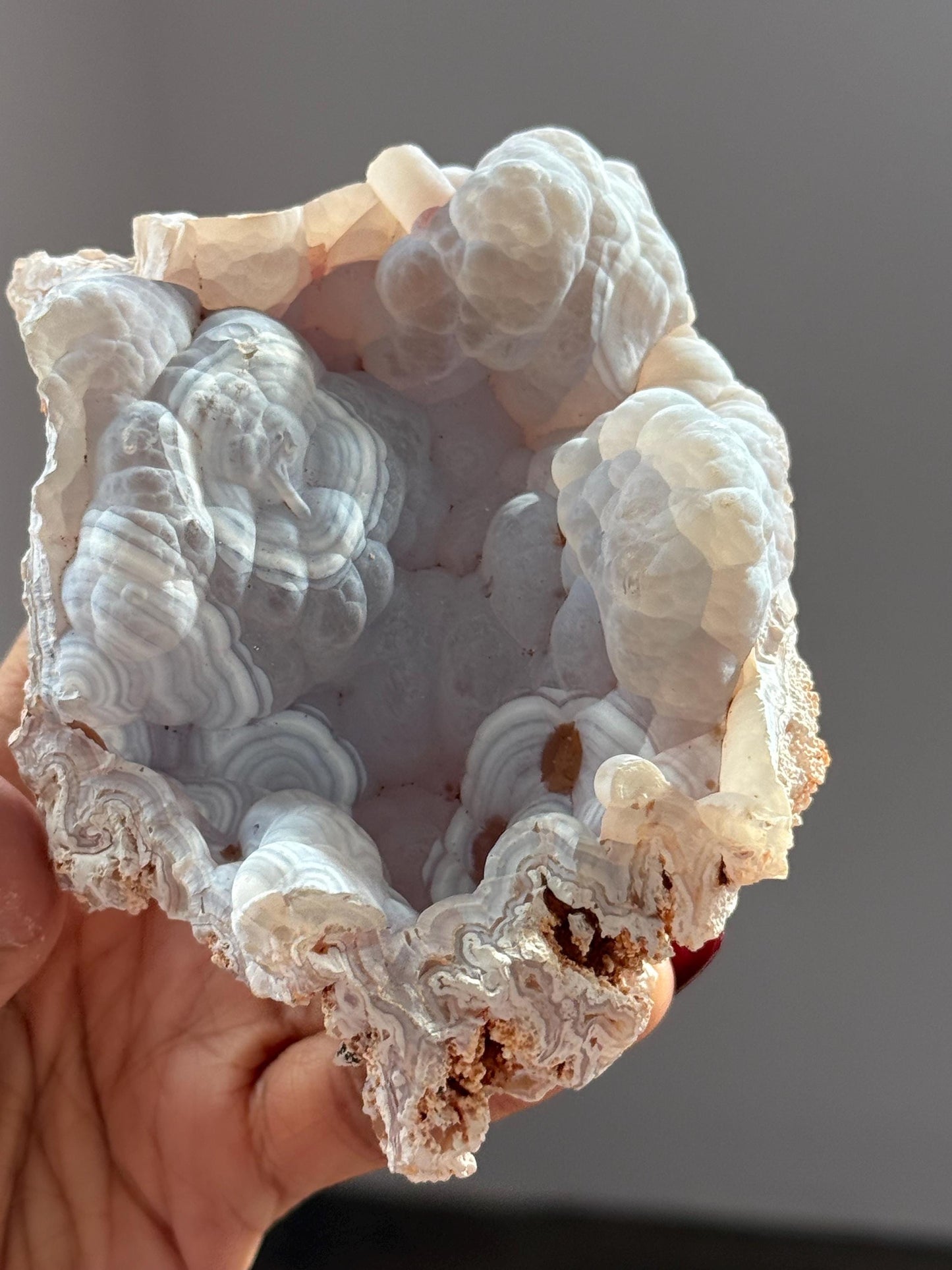Rare Orca Agate Specimen – Raw Botryoidal Chalcedony Crystal, Natural Mineral Fossil, Collector’s Healing Stone Gift